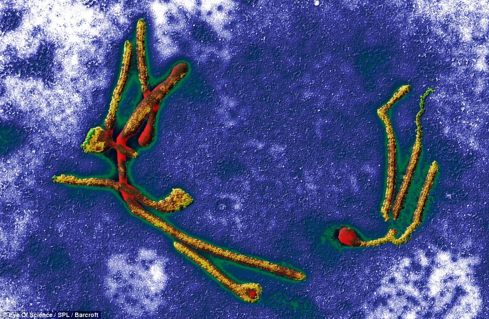 Trông tựa như cái treo trên tường ở một phòng trưng bày nghệ thuật, nhưng thật ra đây là virus Ebola nhìn qua kính hiển vi điện tử truyền qua có màu