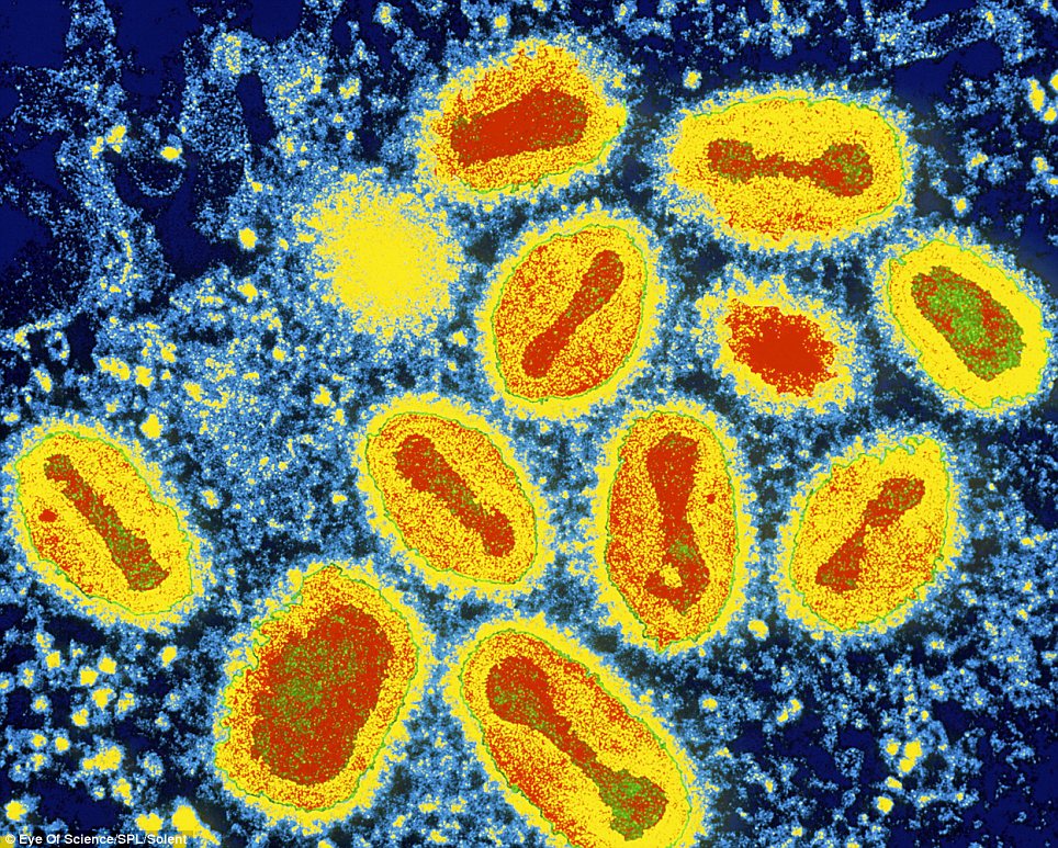 Virus đậu mùa, trông như một bức tranh sơn dầu