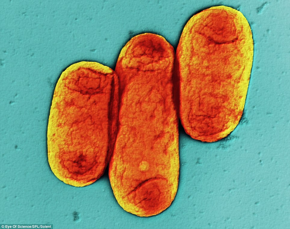 Vi khuẩn dịch hạch