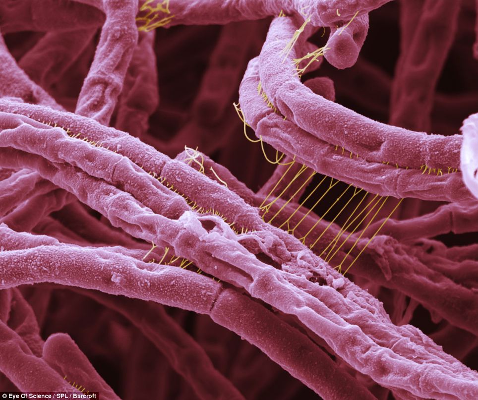 Vi khuẩn hình que gây bệnh than Bacillus anthracis