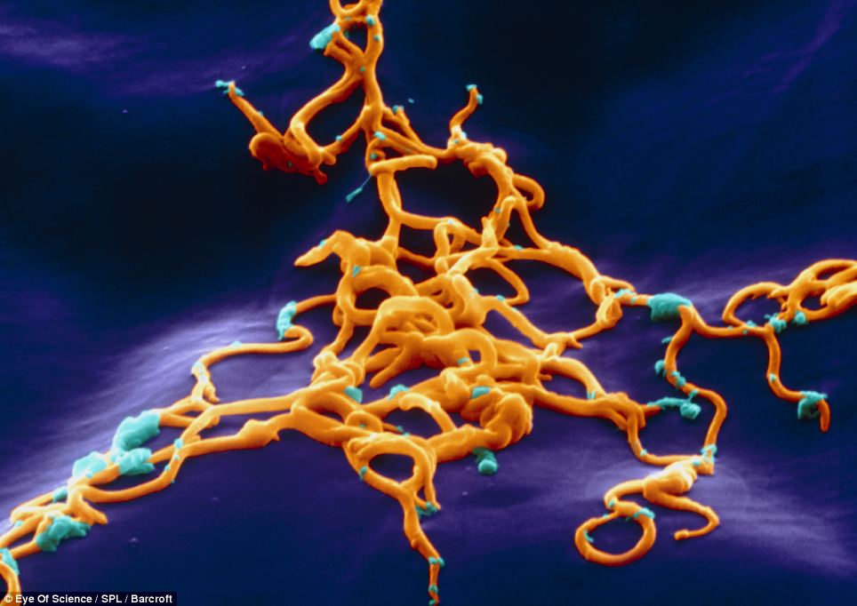 Ảnh hiển vi điện tử quét màu của khuẩn xoắn Borrelia burgdorferi