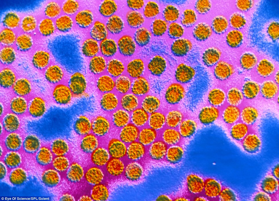 Ảnh màu giả của virus u nhú (Papilloma)