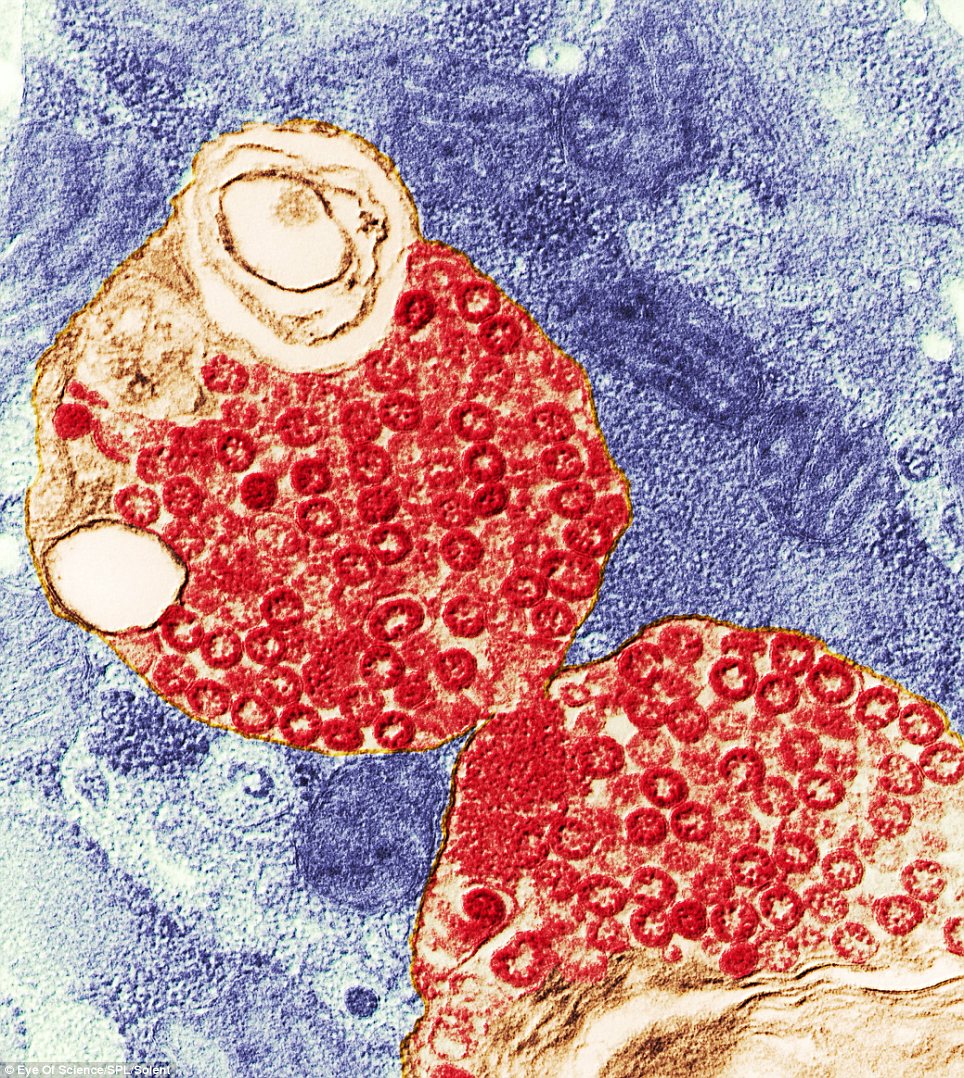 Những hạt virus SARS (màu đỏ) trong một tế bào chủ